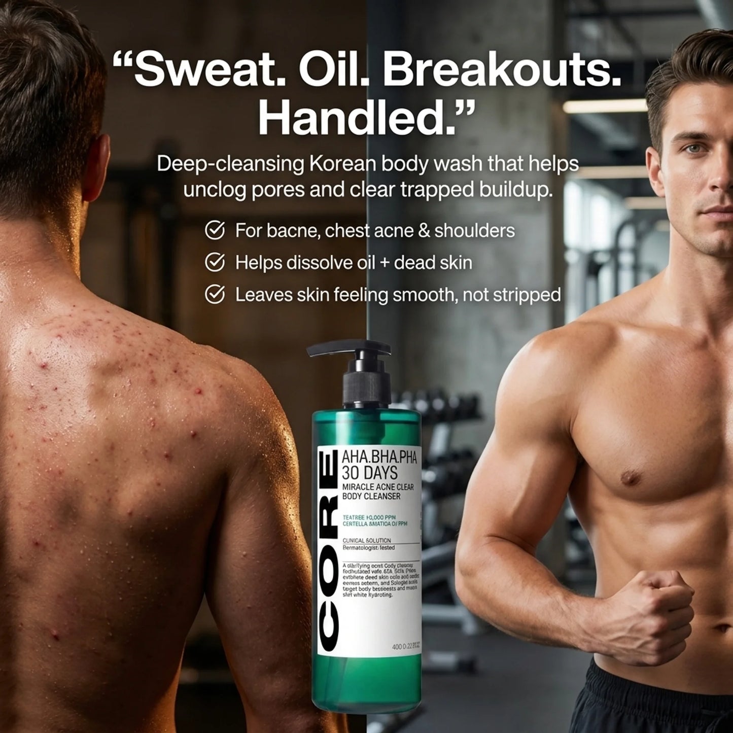 Miracle Acne Cleanser