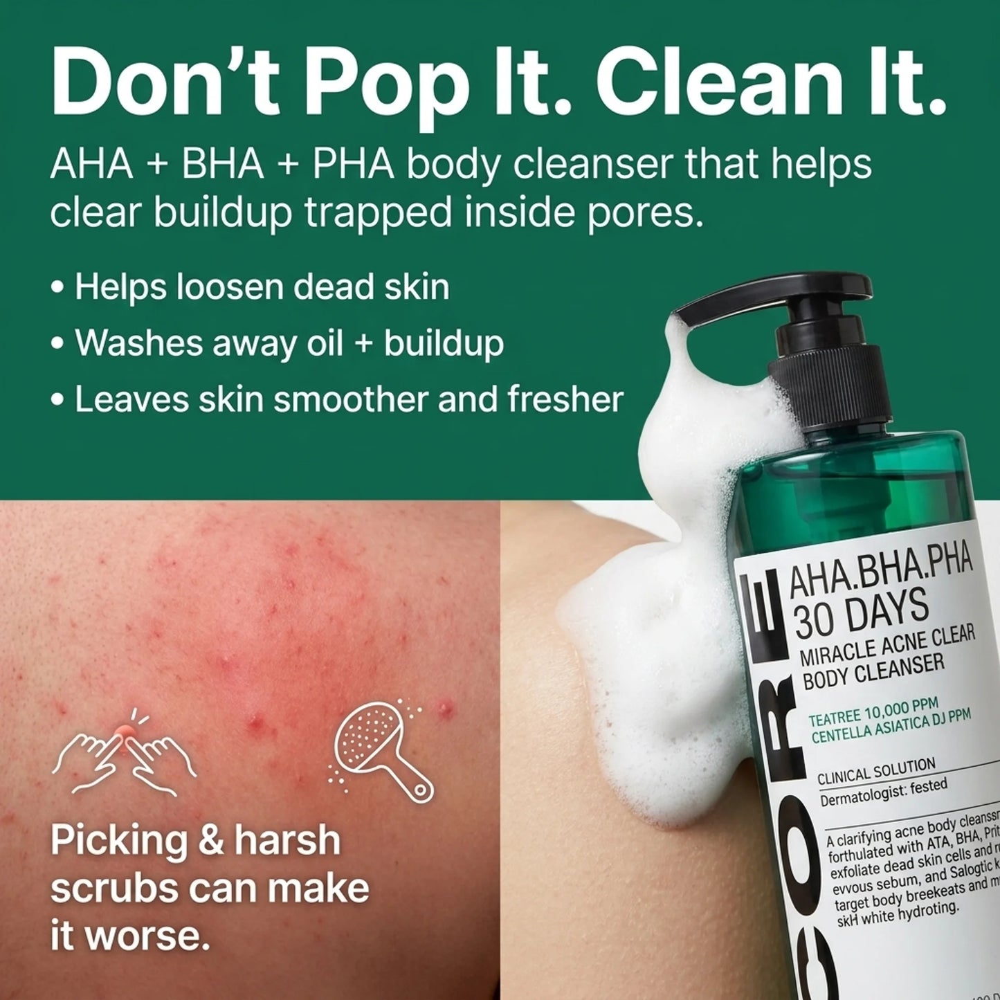 Miracle Acne Cleanser